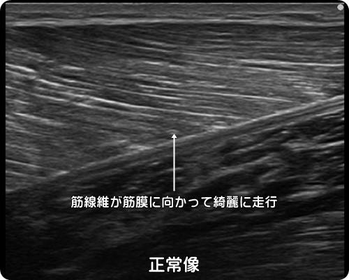 ふくらはぎの痛み・病院・整形外科