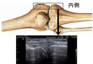 京都市中京区右京区下京区膝痛治療